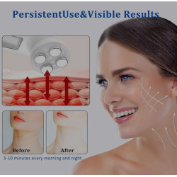Face Lifting Device