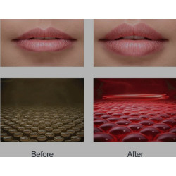 Lescolton Lip Care Device
